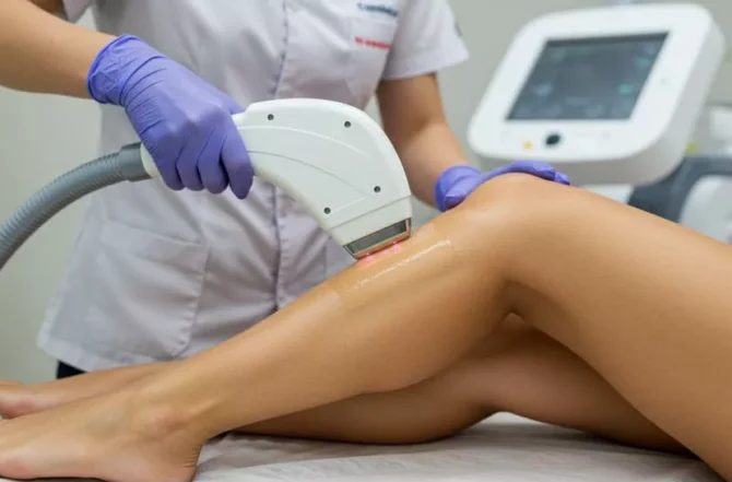Depilação a Laser