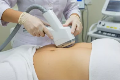 Lipoescultura Não Invasiva (Cryolipólise)