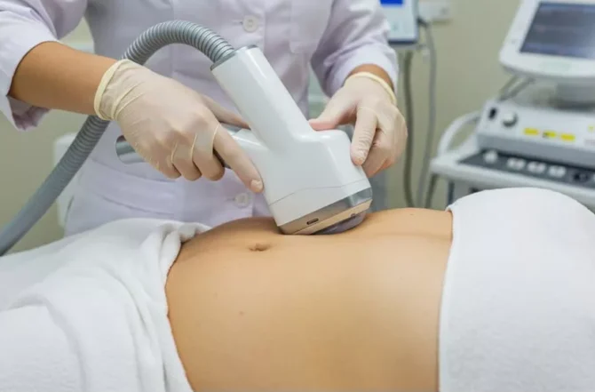 Lipoescultura Não Invasiva (Cryolipólise)